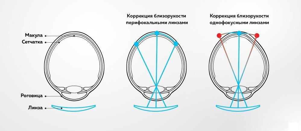 Перифокал