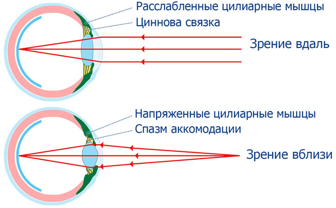 аккомодация
