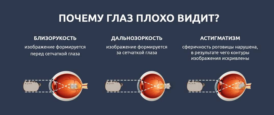 как видит дальнозоркость, близорукость или астигматизм.  